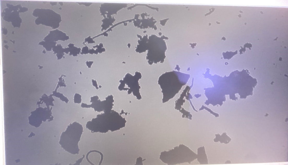 Hình4: Hình ảnh dị vật trên cảm biến của camera được hệ thống thu lại